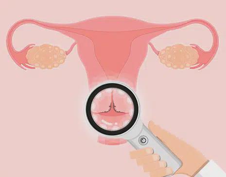 6 Images Of Your Cervix You Need To See