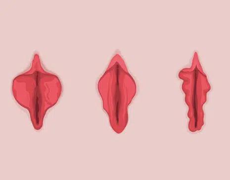 The Different Types of Vulvas